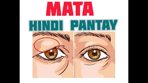 Hindi pantay na talukap ng mata